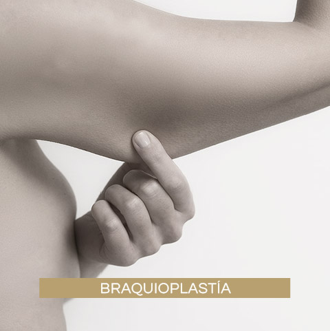 Braquioplastía