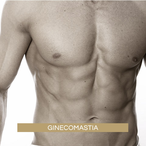 Ginecomastia (crecimiento de Glándula Mamaria Masculina)