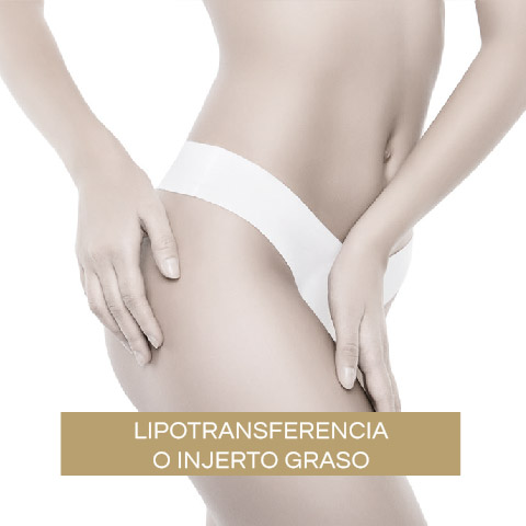 Lipotransferencia o Injerto Graso (auto-transplante de grasa)
