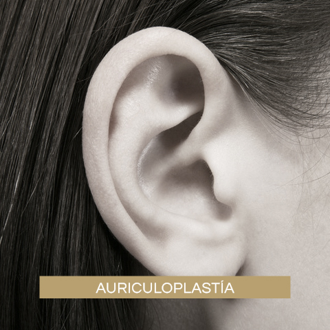 Auriculoplastía - Orejas en Asa