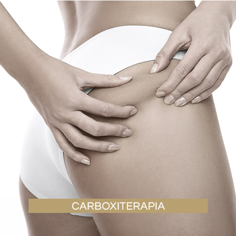 Carboxiterapia